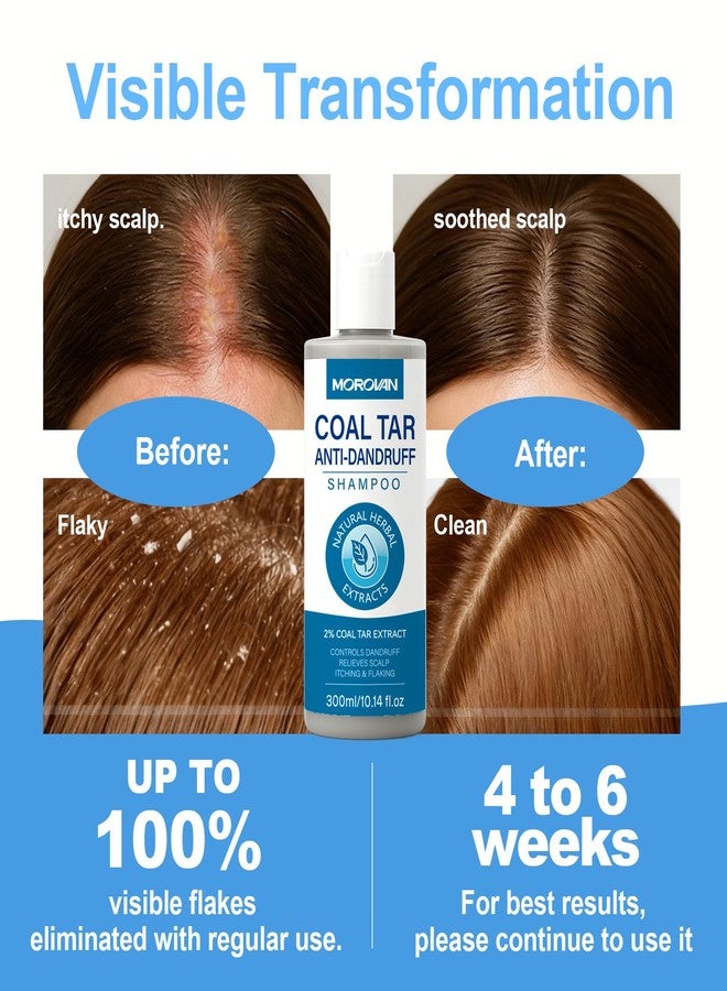 Morovan Coal Tar Dandruff Shampoo: 2% COAL TAR Extract for Severe Dandruff, Psoriasis & Itchy Scalp | Medicated Treatment for Seborrheic Dermatitis - Effective Flake and Itch Control. - Image 5